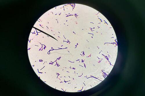 Les vaccins à ARNm COVID-19 réduisent les bactéries appartenant au genre Bifidobacteria, une bactérie intestinale commune et bénéfique.